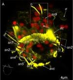 Mouse IgG (H+L) Cross-Adsorbed Secondary Antibody in Immunohistochemistry (IHC)