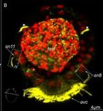 Rabbit IgG (H+L) Cross-Adsorbed Secondary Antibody in Immunohistochemistry (IHC)