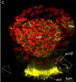 Mouse IgG (H+L) Cross-Adsorbed Secondary Antibody in Immunohistochemistry (IHC)