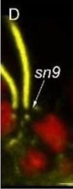 Mouse IgG (H+L) Cross-Adsorbed Secondary Antibody in Immunohistochemistry (IHC)