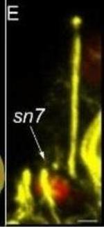 Mouse IgG (H+L) Cross-Adsorbed Secondary Antibody in Immunohistochemistry (IHC)