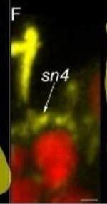Rabbit IgG (H+L) Cross-Adsorbed Secondary Antibody in Immunohistochemistry (IHC)