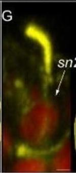 Rabbit IgG (H+L) Cross-Adsorbed Secondary Antibody in Immunohistochemistry (IHC)