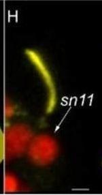 Mouse IgG (H+L) Cross-Adsorbed Secondary Antibody in Immunohistochemistry (IHC)