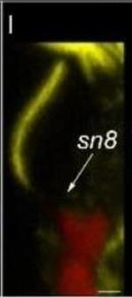 Mouse IgG (H+L) Cross-Adsorbed Secondary Antibody in Immunohistochemistry (IHC)