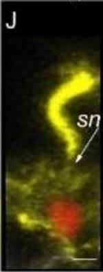 Mouse IgG (H+L) Cross-Adsorbed Secondary Antibody in Immunohistochemistry (IHC)