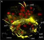Mouse IgG (H+L) Cross-Adsorbed Secondary Antibody in Immunohistochemistry (IHC)