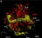 Rabbit IgG (H+L) Cross-Adsorbed Secondary Antibody in Immunohistochemistry (IHC)