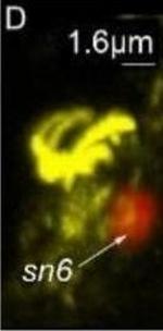 Rabbit IgG (H+L) Cross-Adsorbed Secondary Antibody in Immunohistochemistry (IHC)