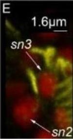 Mouse IgG (H+L) Cross-Adsorbed Secondary Antibody in Immunohistochemistry (IHC)