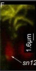 Mouse IgG (H+L) Cross-Adsorbed Secondary Antibody in Immunohistochemistry (IHC)