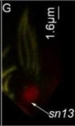 Mouse IgG (H+L) Cross-Adsorbed Secondary Antibody in Immunohistochemistry (IHC)