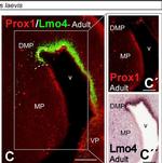 Rabbit IgG (H+L) Cross-Adsorbed Secondary Antibody in Immunohistochemistry (IHC)