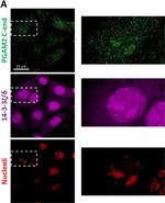 Rabbit IgG (H+L) Cross-Adsorbed Secondary Antibody in Immunocytochemistry (ICC/IF)
