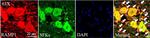Rabbit IgG (H+L) Highly Cross-Adsorbed Secondary Antibody in Immunohistochemistry (IHC)