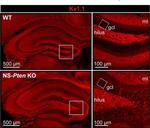 Mouse IgG2b Cross-Adsorbed Secondary Antibody in Immunohistochemistry (IHC)