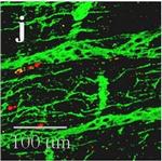 Mouse IgG (H+L) Highly Cross-Adsorbed Secondary Antibody in Immunohistochemistry (IHC)