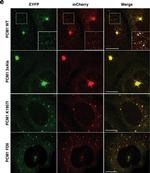 Rabbit IgG (H+L) Highly Cross-Adsorbed Secondary Antibody in Immunocytochemistry (ICC/IF)