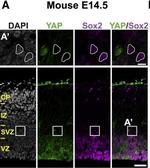 Rabbit IgG (H+L) Secondary Antibody in Immunocytochemistry (ICC/IF)