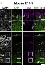 Rabbit IgG (H+L) Secondary Antibody in Immunocytochemistry (ICC/IF)