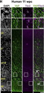 Rabbit IgG (H+L) Secondary Antibody in Immunocytochemistry (ICC/IF)