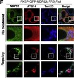 Rabbit IgG (H+L) Highly Cross-Adsorbed Secondary Antibody in Immunocytochemistry (ICC/IF)