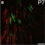 Rat IgG (H+L) Highly Cross-Adsorbed Secondary Antibody in Immunohistochemistry (IHC)