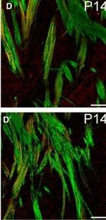 Rat IgG (H+L) Highly Cross-Adsorbed Secondary Antibody in Immunohistochemistry (IHC)