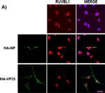Rabbit IgG (H+L) Cross-Adsorbed Secondary Antibody in Immunocytochemistry (ICC/IF)