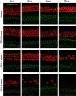 Mouse IgG1 Cross-Adsorbed Secondary Antibody in Immunohistochemistry (IHC)