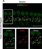 Mouse IgG2a Cross-Adsorbed Secondary Antibody in Immunohistochemistry (IHC)