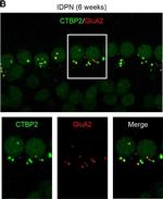 Mouse IgG2a Cross-Adsorbed Secondary Antibody in Immunohistochemistry (IHC)