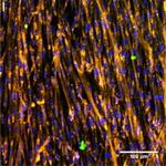 Rabbit IgG (H+L) Cross-Adsorbed Secondary Antibody in Immunocytochemistry (ICC/IF)