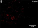 Rabbit IgG (H+L) Cross-Adsorbed Secondary Antibody in Immunocytochemistry (ICC/IF)
