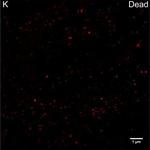 Rabbit IgG (H+L) Cross-Adsorbed Secondary Antibody in Immunocytochemistry (ICC/IF)