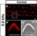 Rabbit IgG (H+L) Cross-Adsorbed Secondary Antibody in Immunohistochemistry (IHC)