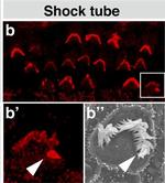 Rabbit IgG (H+L) Cross-Adsorbed Secondary Antibody in Immunohistochemistry (IHC)