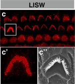 Rabbit IgG (H+L) Cross-Adsorbed Secondary Antibody in Immunohistochemistry (IHC)