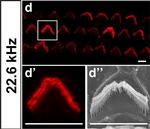 Rabbit IgG (H+L) Cross-Adsorbed Secondary Antibody in Immunohistochemistry (IHC)
