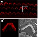 Rabbit IgG (H+L) Cross-Adsorbed Secondary Antibody in Immunohistochemistry (IHC)