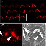 Rabbit IgG (H+L) Cross-Adsorbed Secondary Antibody in Immunohistochemistry (IHC)