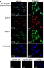 Rabbit IgG (H+L) Highly Cross-Adsorbed Secondary Antibody in Immunocytochemistry (ICC/IF)