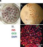 Mouse IgG (H+L) Highly Cross-Adsorbed Secondary Antibody in Immunocytochemistry (ICC/IF)