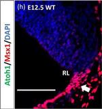 Goat IgG (H+L) Cross-Adsorbed Secondary Antibody in Immunohistochemistry (IHC)