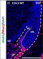 Goat IgG (H+L) Cross-Adsorbed Secondary Antibody in Immunohistochemistry (IHC)