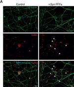 Rabbit IgG (H+L) Highly Cross-Adsorbed Secondary Antibody in Immunocytochemistry (ICC/IF)