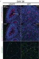 Rat IgG (H+L) Highly Cross-Adsorbed Secondary Antibody in Immunocytochemistry (ICC/IF)