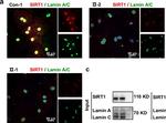 Rabbit IgG (H+L) Cross-Adsorbed Secondary Antibody in Immunocytochemistry (ICC/IF)