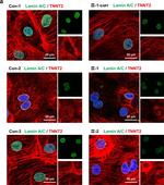 Rabbit IgG (H+L) Cross-Adsorbed Secondary Antibody in Immunocytochemistry (ICC/IF)