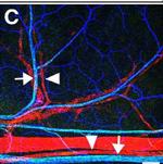 Chicken IgY (H+L) Secondary Antibody in Immunohistochemistry (IHC)